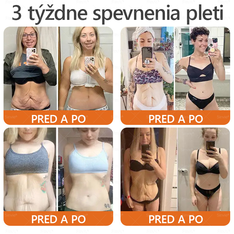 🐝 Sinvie® včelím jedom obnovu pokožky Krém (👨⚕CE schválené)👍✅