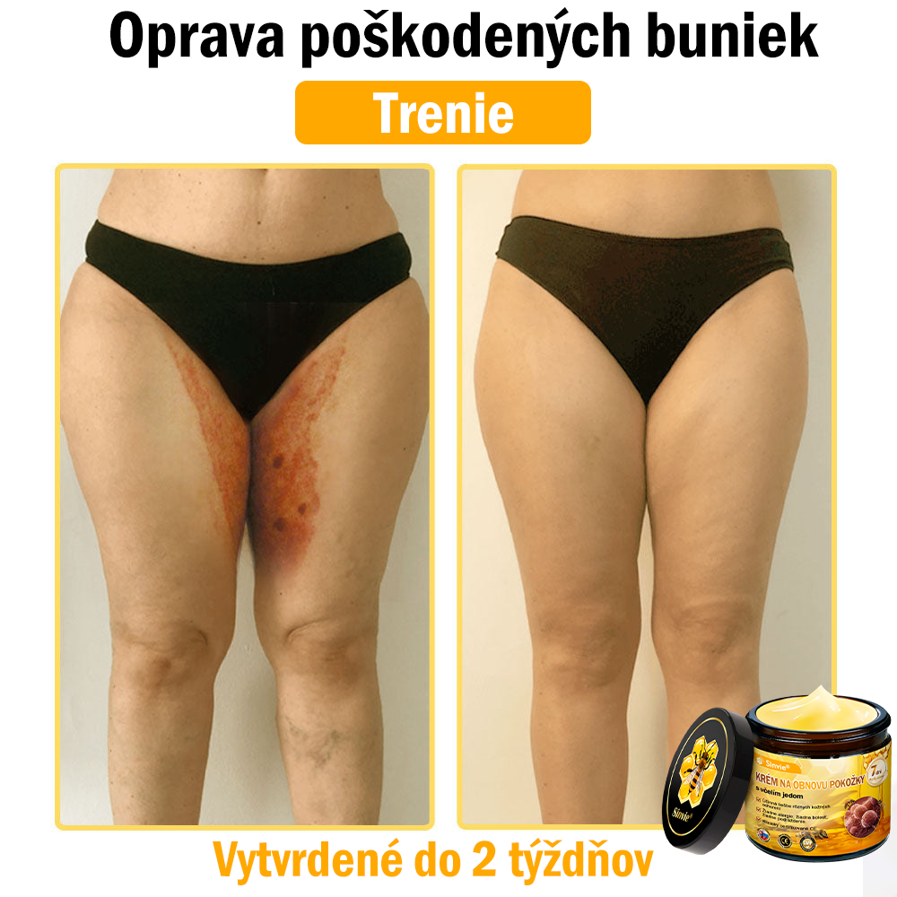 🐝 Sinvie® včelím jedom obnovu pokožky Krém (👨⚕CE schválené)👍✅