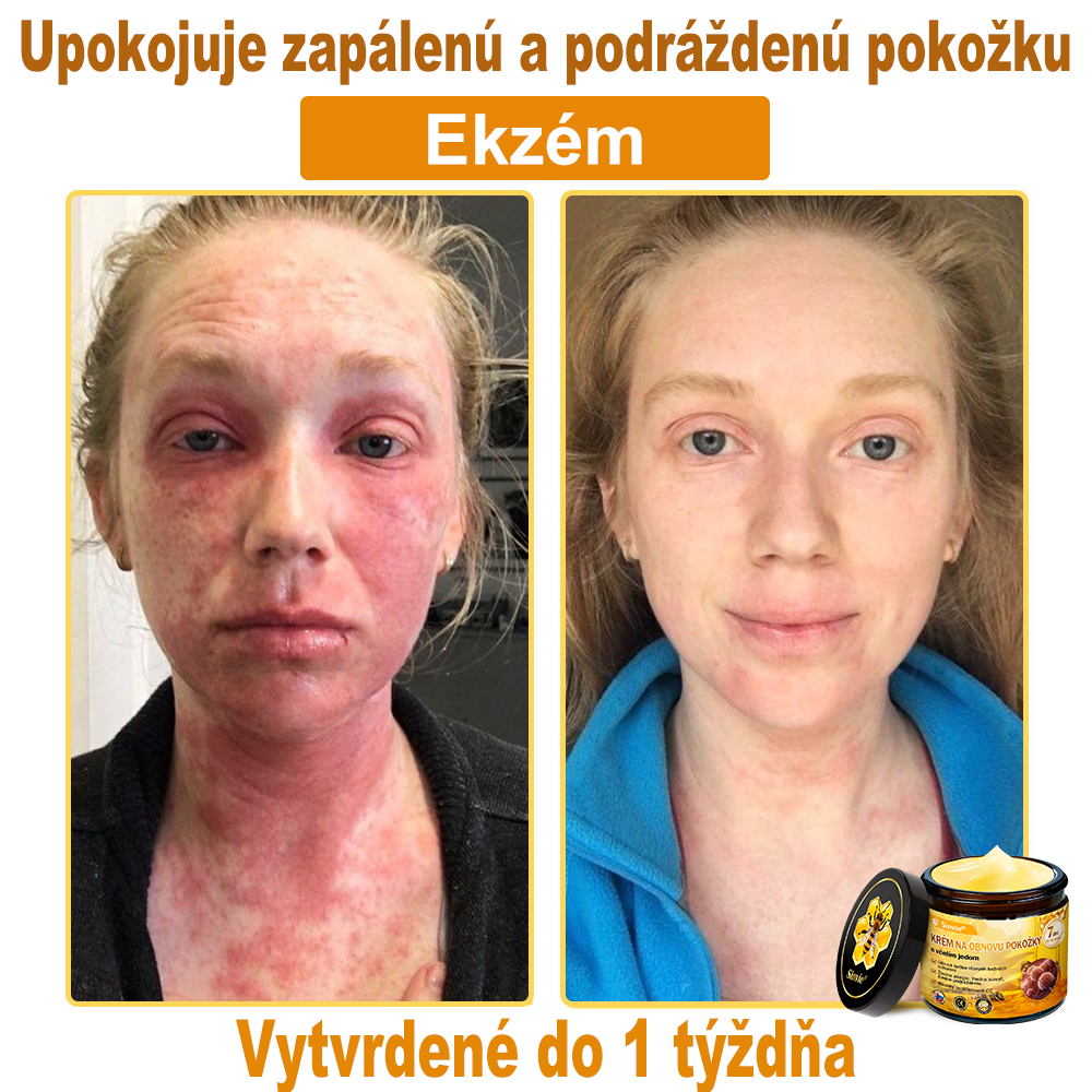 🐝 Sinvie® včelím jedom obnovu pokožky Krém (👨⚕CE schválené)👍✅
