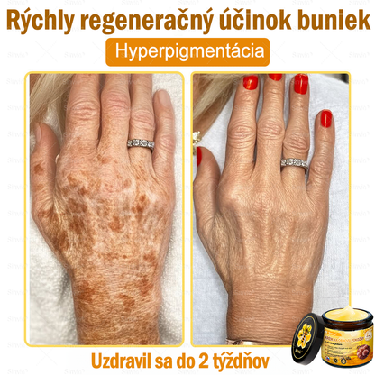 🐝 Sinvie® včelím jedom obnovu pokožky Krém (👨‍⚕‍CE schválené)👍✅