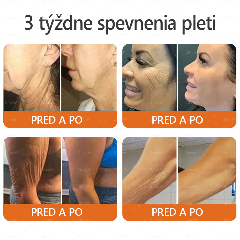 🐝 Sinvie® včelím jedom obnovu pokožky Krém (👨‍⚕‍CE schválené)👍✅
