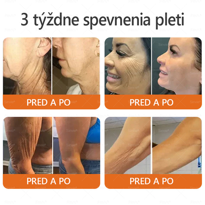 🐝 Sinvie® včelím jedom obnovu pokožky Krém (👨‍⚕‍CE schválené)👍✅