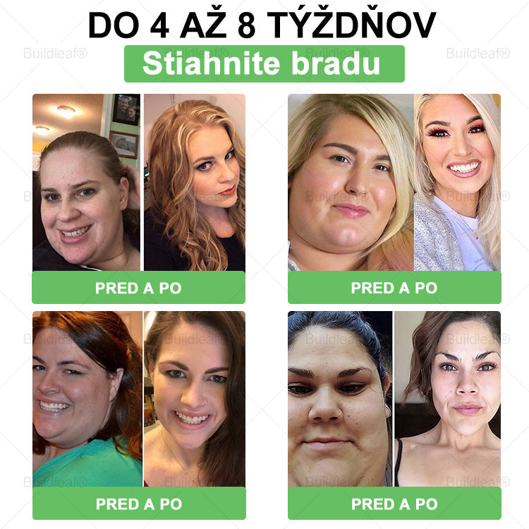 🧑‍⚕️🧑‍⚕️BuildLeaf® GLP-1 6-v-1 Fit & Vital Perorálny Roztok (Len raz denne, viditeľné zmeny už za 7 dní) Pre obezitu, kardiovaskulárne ochorenia, cukrovku, spánkové apnoe, zdravie čriev, problémy s kĺbmi a ďalšie