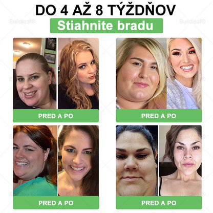 🧑‍⚕️🧑‍⚕️BuildLeaf® GLP-1 6-v-1 Fit & Vital Perorálny Roztok (Len raz denne, viditeľné zmeny už za 7 dní) Pre obezitu, kardiovaskulárne ochorenia, cukrovku, spánkové apnoe, zdravie čriev, problémy s kĺbmi a ďalšie