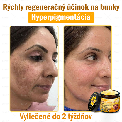 🐝 Sinvie® včelím jedom obnovu pokožky Krém (👨‍⚕‍CE schválené)👍✅
