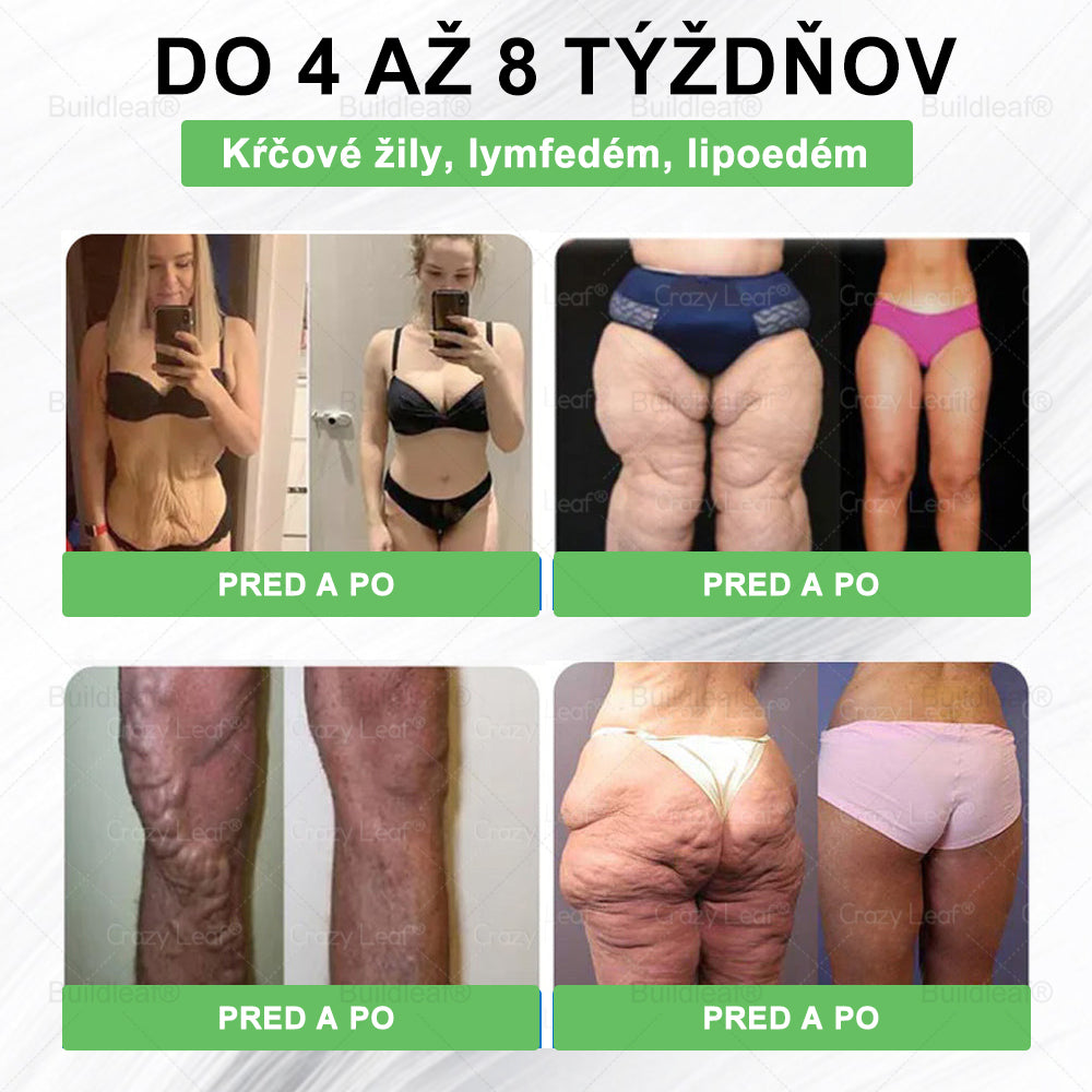 🧑‍⚕️🧑‍⚕️BuildLeaf® GLP-1 6-v-1 Fit & Vital Perorálny Roztok (Len raz denne, viditeľné zmeny už za 7 dní) Pre obezitu, kardiovaskulárne ochorenia, cukrovku, spánkové apnoe, zdravie čriev, problémy s kĺbmi a ďalšie